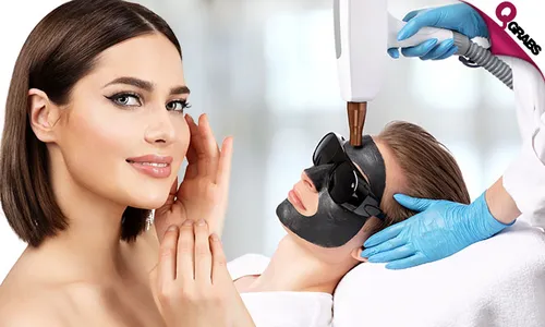 Carbon Peel & Laser Lightening or Toning Treatments!